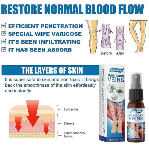 (1pcs) varicose vein massage spray 1 piece 1