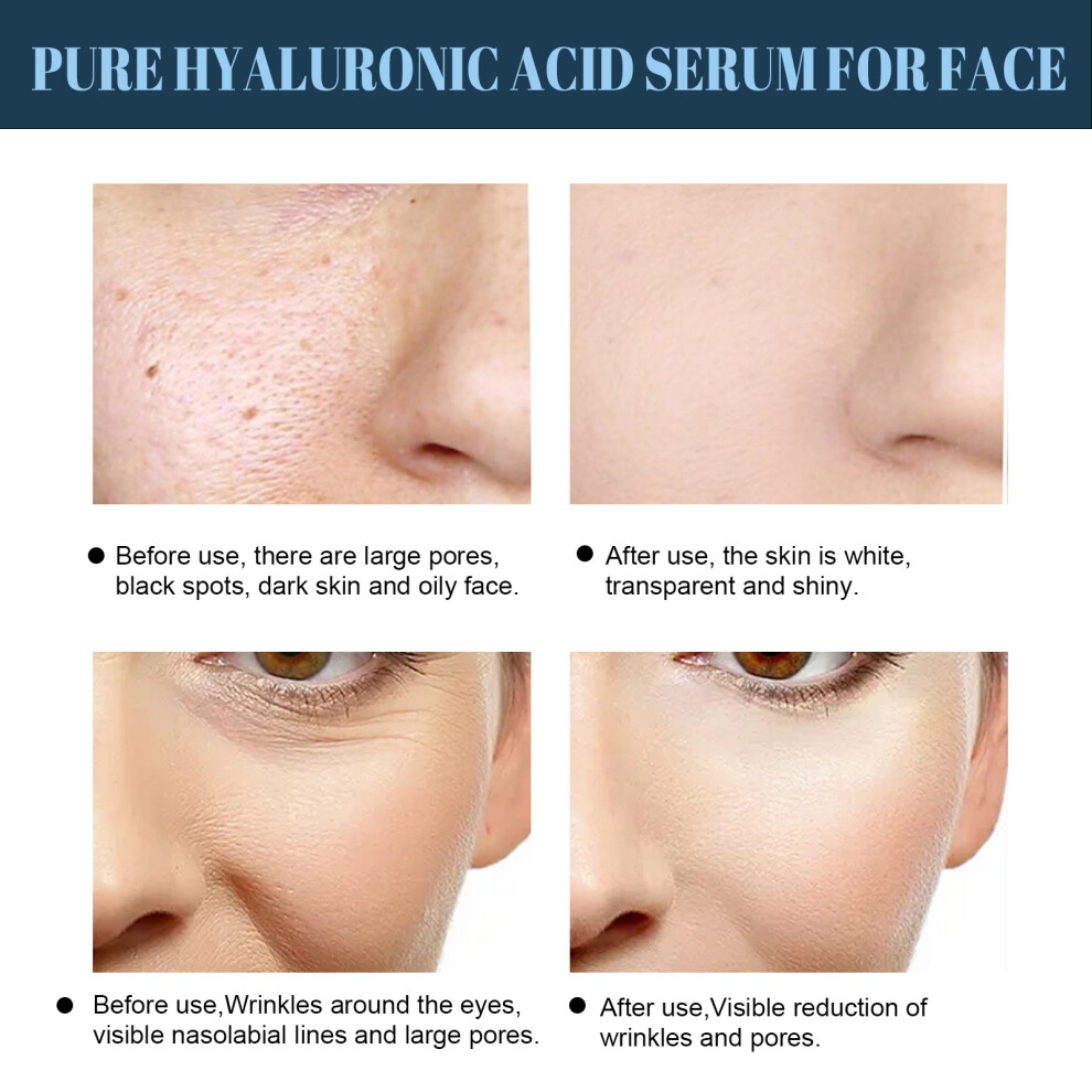 EELHOE Protein Lift Line Anti-Wrinkle V-Face Firming Lifting