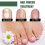 EELHOE 30ml Nagelzwambehandeling 2