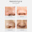 LANBENA Blackhead Mask 60pcs Pore Shrink Peeling 3