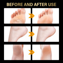 Jaysuing 2 Pairs Lavender Foot Mask Exfoliating Moisturizing