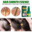 EELHOE Haarwuchsserum 30ml für Kopfhaut 3