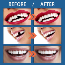 Moldable False Teeth 25g Cosplay Halloween Party Decor
