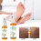 EELHOE 100ml Fußpeeling-Spray gegen Hornhaut 2