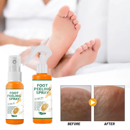 EELHOE 100ml Fußpeeling-Spray gegen Hornhaut 1