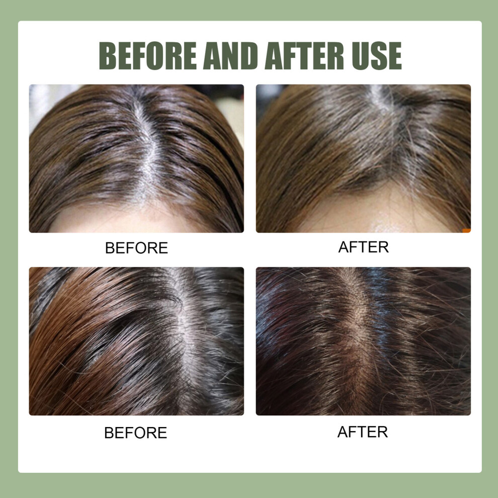 Cream Eelhoe Centella Sea Salt Shampoo Oil Control Dandruff 100G