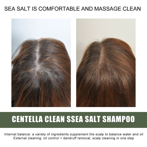 EELHOE Centella Sea Salt Shampoo Oil Control Dandruff 100g 1