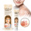 20g White Spot Vitiligo Herbal Ointment 1