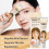 20g White Spot Vitiligo Herbal Ointment 5