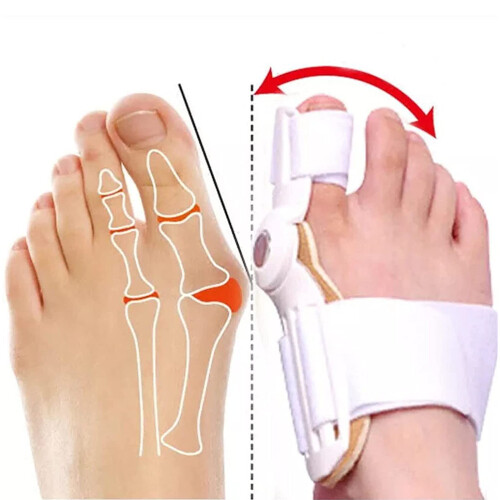 Valux Bunion Corrector Toe Separator 1
