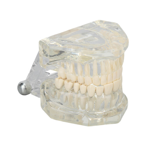 Modello dentale trasparente per esposizione clinica 1