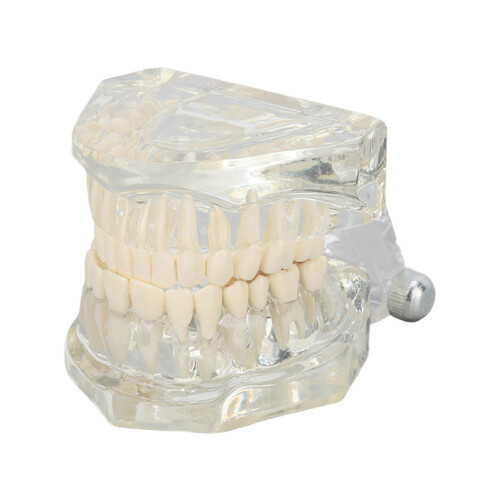 Modello dentale trasparente per esposizione clinica 2