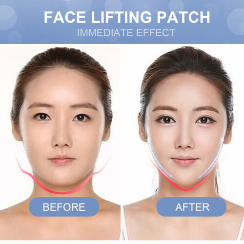 EELHOE 40Pcs Face Lifting Patches Waterproof Slimming 1