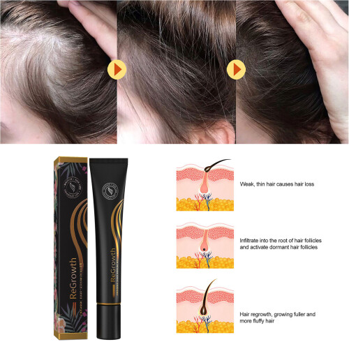 EELHOE 20ml Haar-Rollen-Extrakt gegen Haarausfall (2 Stk.) 2