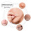 20 Pcs Hydrocolloid Acne Patches Waterproof Face Care Stickers 5