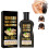 100ml Ingwer-Shampoo gegen Haarausfall & Schuppen 1