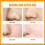 10Pcs Nose Patches Hydrocolloid Blackhead Oil Control 5