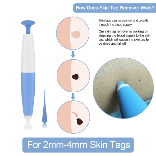 Penna per Segni della Pelle, Strumento per Nevi e Calli 2-4mm