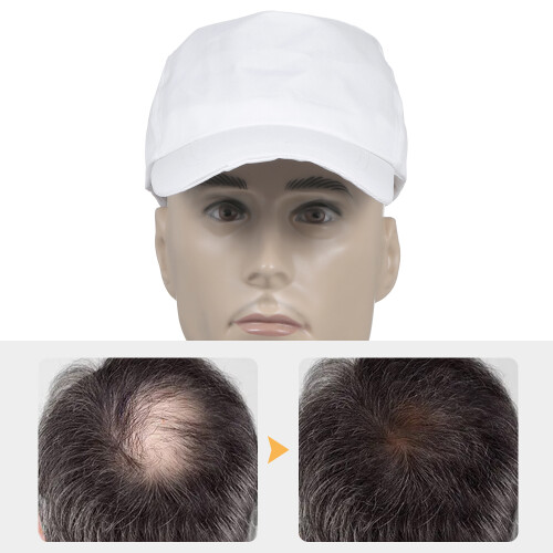 Anti-Haarausfall-Laserkappe: 94/186/240 LEDs 2
