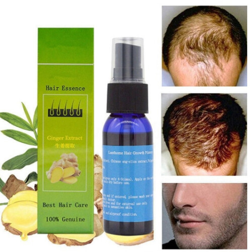 30ml Natuurlijke Extract Anti-Haaruitval Serum