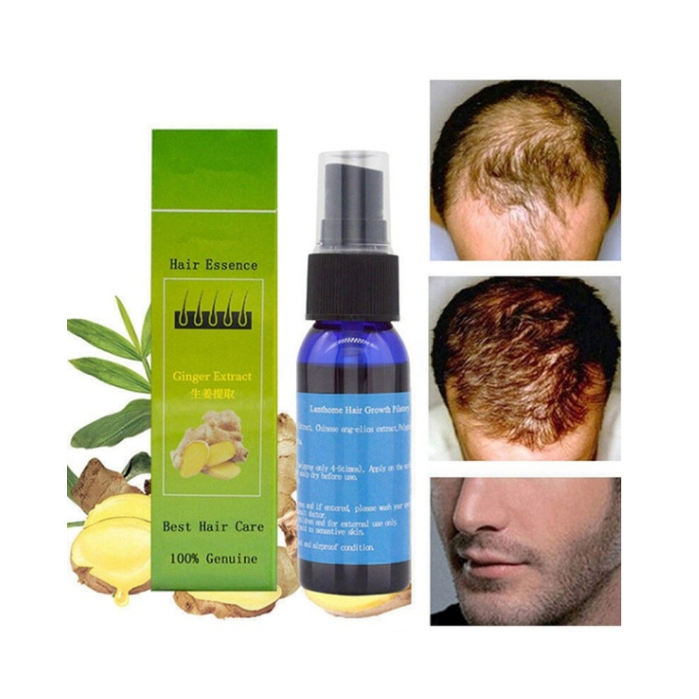 30ml Natural Extract Anti Hair Loss Hair Growth Serum