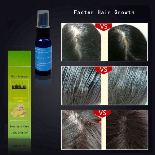 30ml Natuurlijke Extract Anti-Haaruitval Serum 2