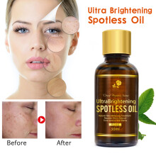 30ml Rosen-Ätherisches Öl feuchtigkeitsspendendes Gesichtsöl