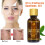 30ml Rose Essential Oil Moisturizing Face Oil 1