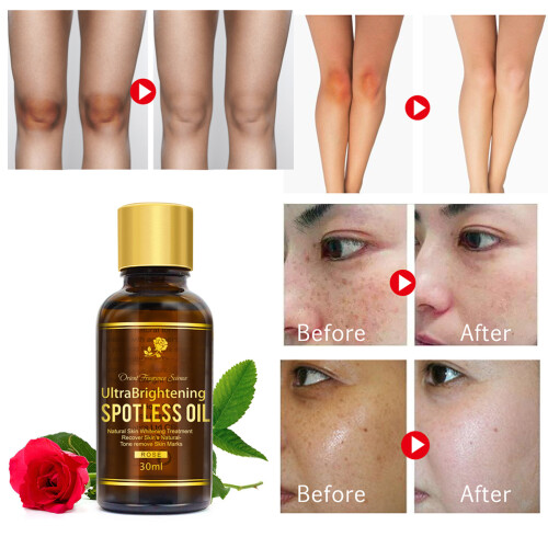 30ml Rose Essential Oil Moisturizing Face Oil 1