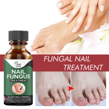 50ML Nail Treatment Solution Repair Liquid Metabolism Onychomycosis