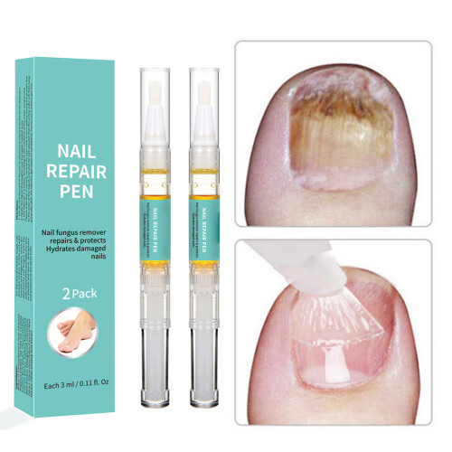 2Pcs Toenail & Nail Care Solution