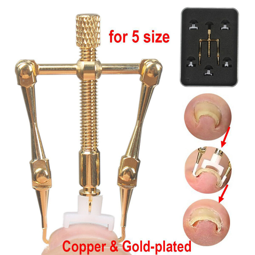 Ingrown Toenail Correction Tool for Paronychia Care