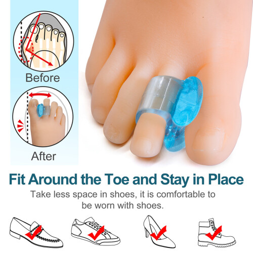 3 Pairs Soft Bunion Spacers Silicone Toe Separator 1