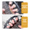 Practice Finger Trainer Justerbar Fingerspridare För Gitarr 8