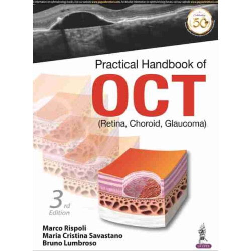 Practical Handbook of OCT by Bruno Lumbroso Paperback Book