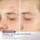 Shark Shark CyroGlow LED Facemask Blue Frost Anti-Ageing 10