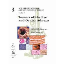 Tumors of the Eye and Ocular Adnexa by Tatyana Millman Hardcover Book