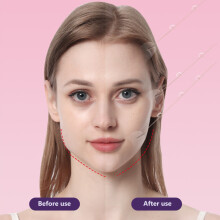 20 Stück transparente Gesichtsstraffung-Sticker, V-Form Gesichtsklebeband, 15,5 g