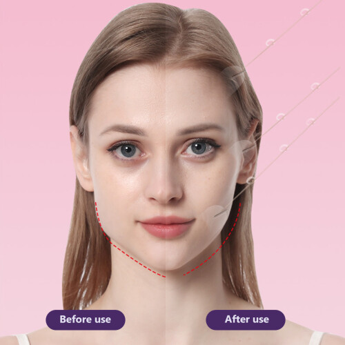 20 Stück transparente Gesichtsstraffung-Sticker, V-Form Gesichtsklebeband, 15,5 g