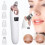 5-in-1 Electric Blackhead Remover Kit 1