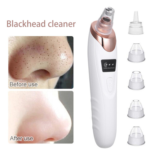5-in-1 Electric Blackhead Remover Kit 1