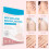Sefudun 108Pcs Hydrocolloid Patches Acne Tag Remover 5
