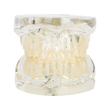 Abnehmbares Modell zahnlösender Zähne Lehrwerkzeug