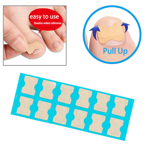 Ingroeiende Teennagel Corrector Stickers Blauw 2