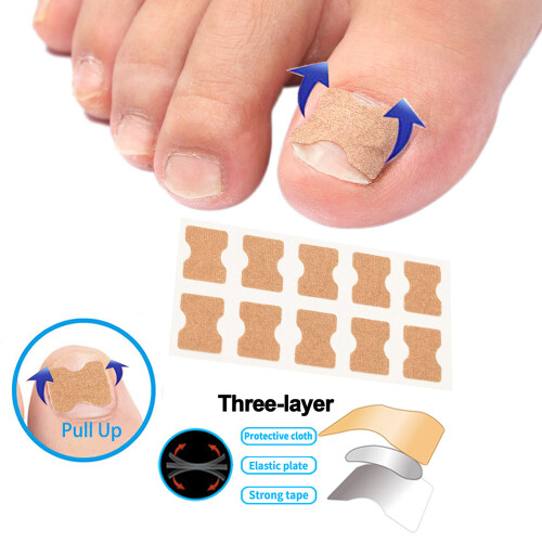 Ingrown-Toenail-Korrekturpflaster ohne Kleber, elastisch
