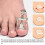 Ingrown Nail Kit Sticker Clamp Lifter 4