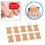 Ingrown-Toenail-Korrekturpflaster ohne Kleber, elastisch 5