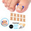 Ingrown-Toenail-Korrekturpflaster ohne Kleber, elastisch 4