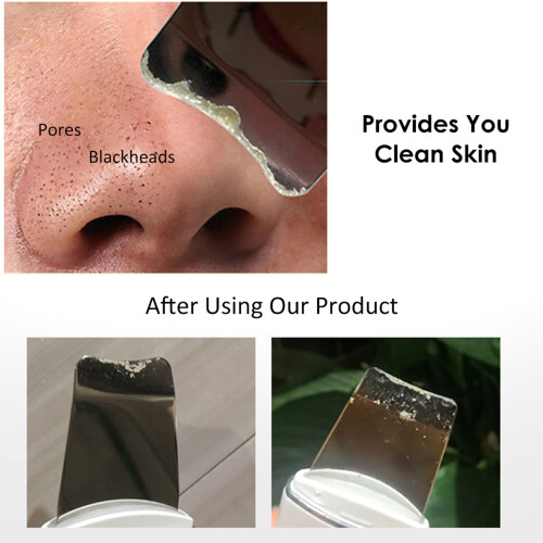 Vibrate Deep Face Cleaning Device Skin Scrubber Lifting Peeler 2