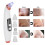 USB Rechargeable Electric Pore Cleaner Blackhead Remover 5